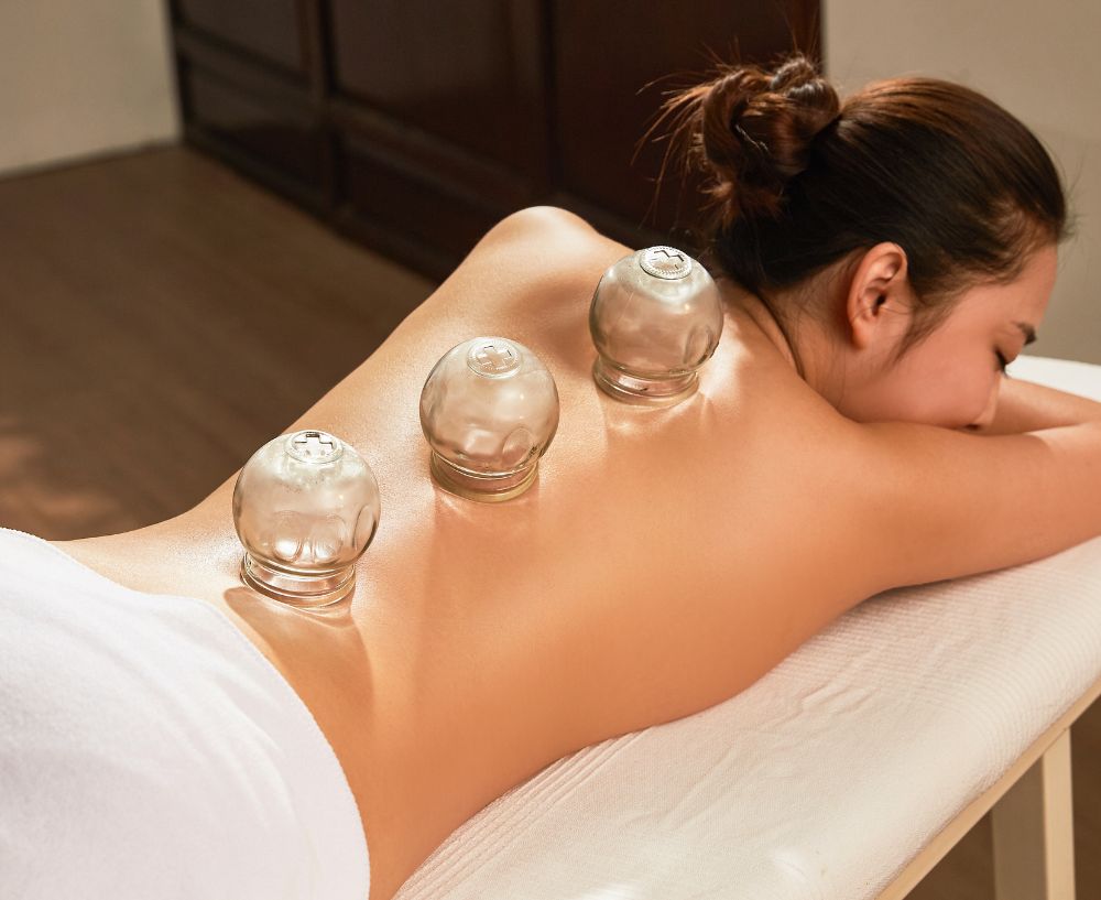Cupping